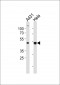 NOVA1 Antibody (Center)